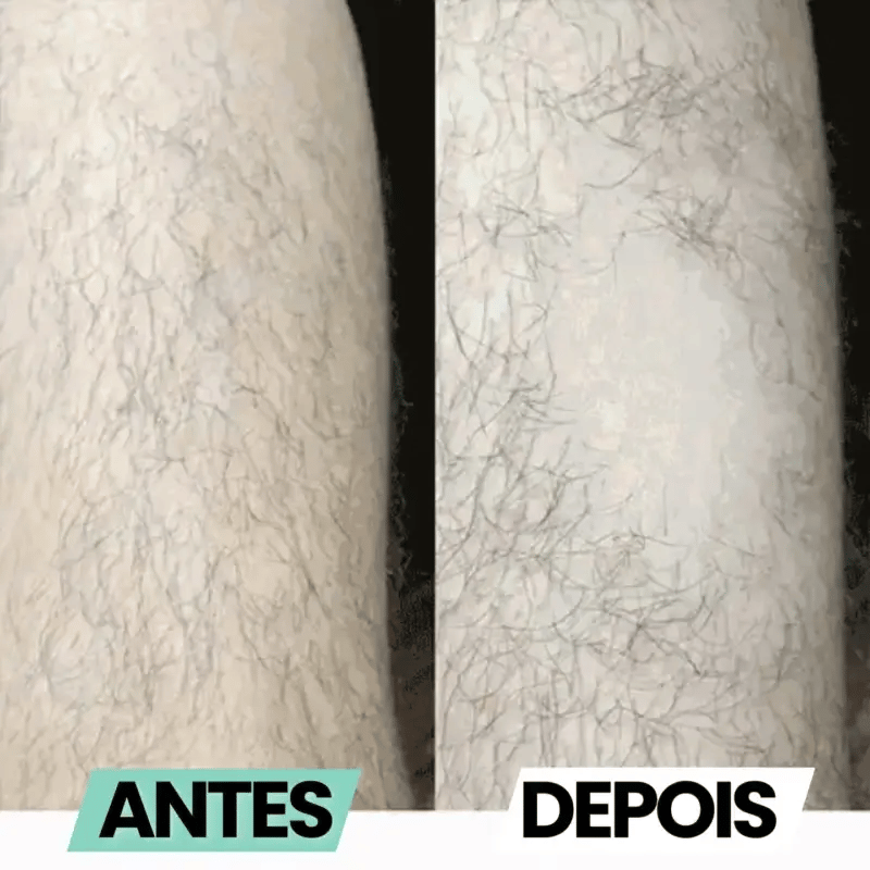 Depiladora de Cristal Healife