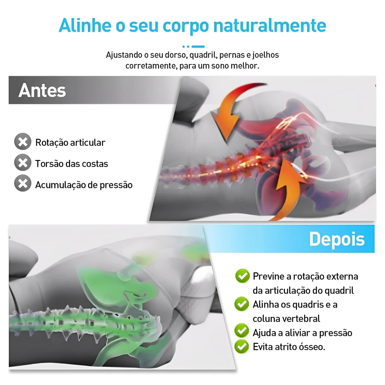 Travesseiro Ortopédico para Pernas Ultra Confortável Sonolev