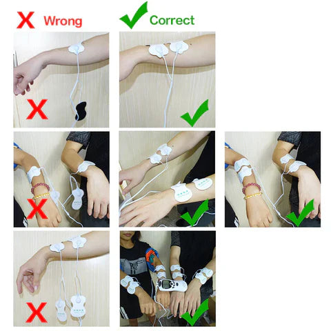 Aparelho De Fisioterapia Portátil Choque Elétrico Acupuntura